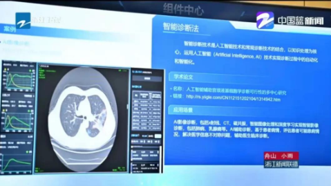 數字化改革：“啄醫(yī)生”智能輔助診斷助力“健康大腦”建設